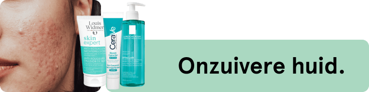 Onzuiverehuid